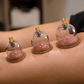 Set de Terapia de Ventosas de Vacío – Engrosado, Bomba de Succión, Transparente